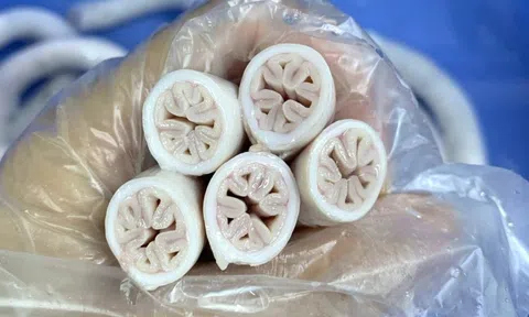 Xử phạt gần 15 triệu đồng 2 quán bán lòng heo tại Tp.HCM
